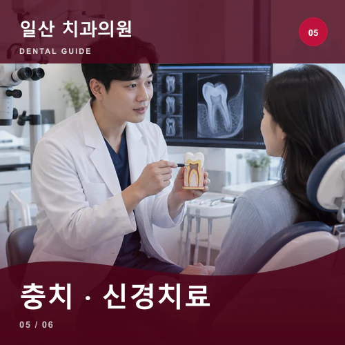 일산치과 | 일산 충치·신경치료, 자연치아를 지킬 범위 확인